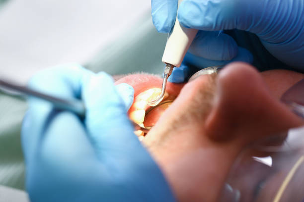 Best Pediatric Emergency Dentist in Ramtown, NJ