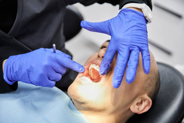 Best Emergency Dental Care for Abscessed Tooth in Ramtown, NJ